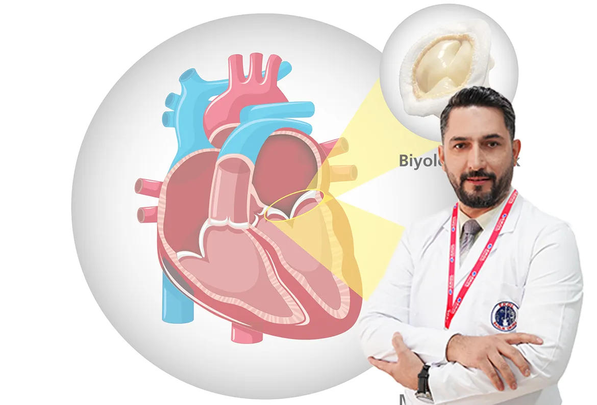 Kalp Kapak Ameliyatlarında Güncel Gelişmeler