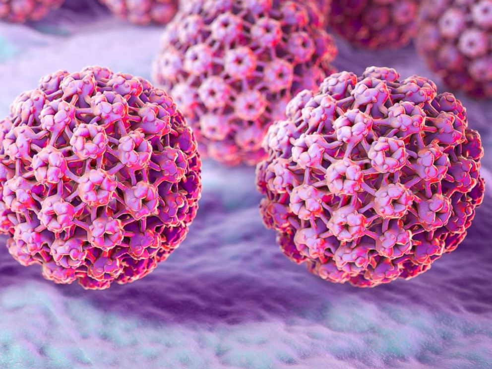 Hpv lazer tedavisi izmir, Hpv belirtisi nedir