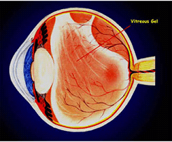 Retina Dekolmanı